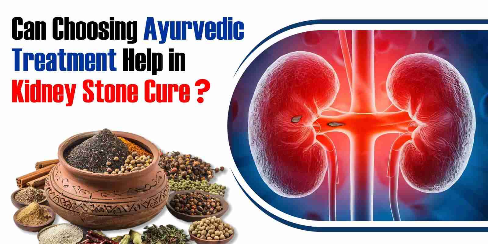 Ayurvedic treatment for kidney stones